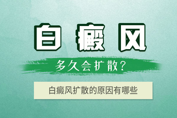 杭州白癜风医院哪个好 腿上的白癜风会扩散到脸上吗